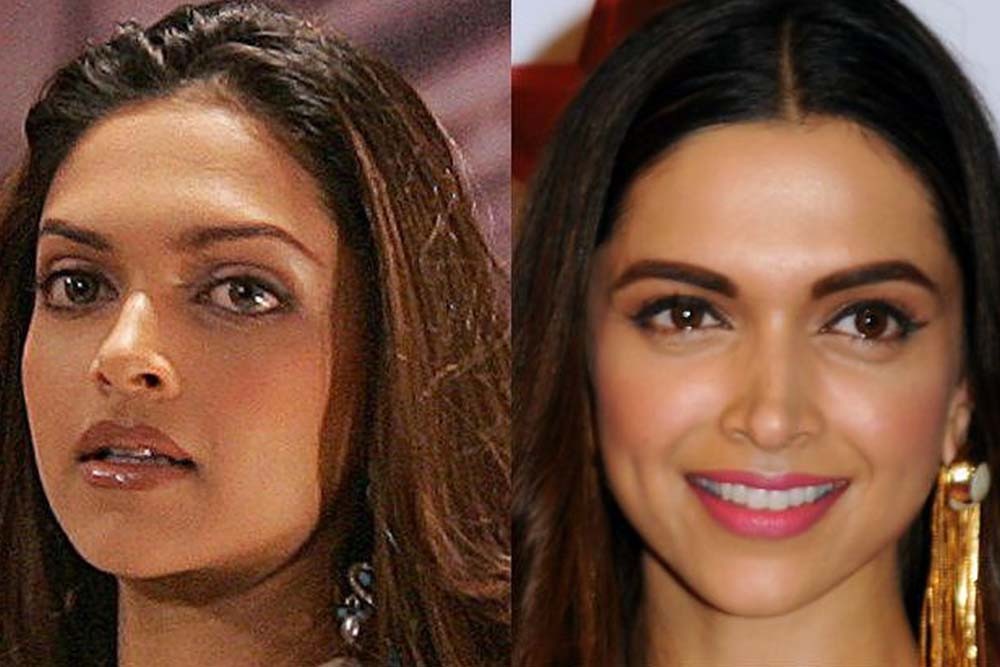 Bollywood Actresses Before & After Microblading — Who Has Perfect Brows Now?