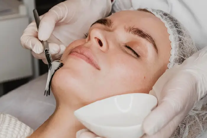 What Is Chemical Peel? Which Age Is Best For A Chemical Peel?