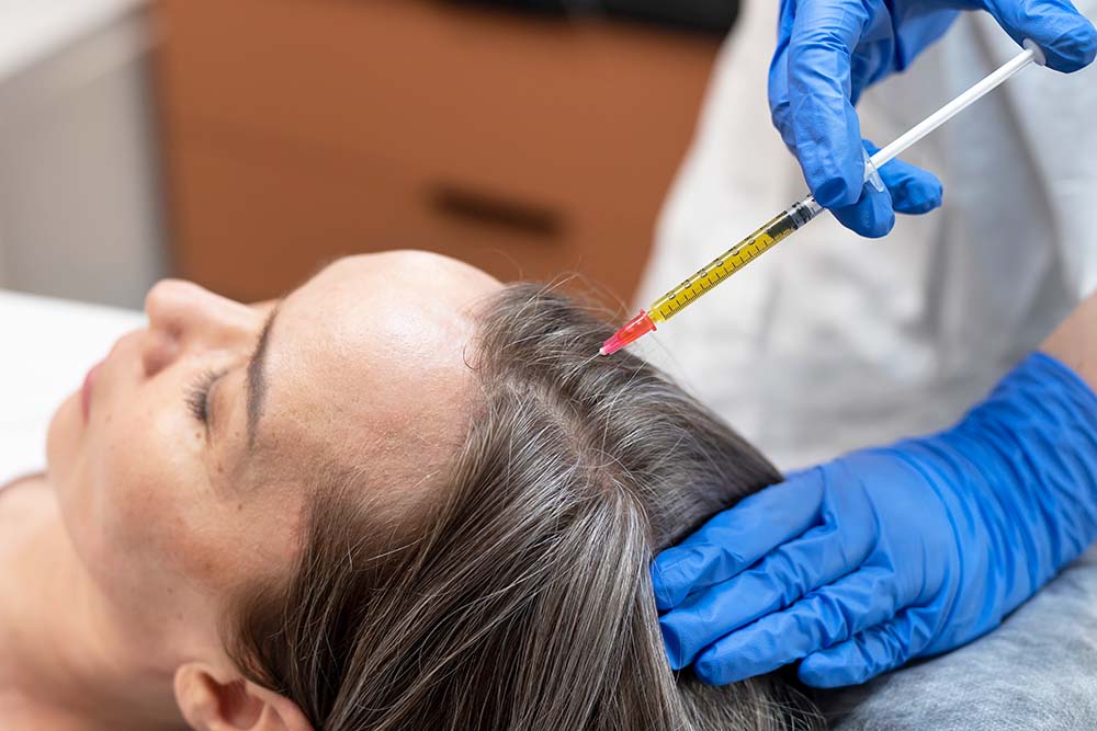 PRP Hair Treatment