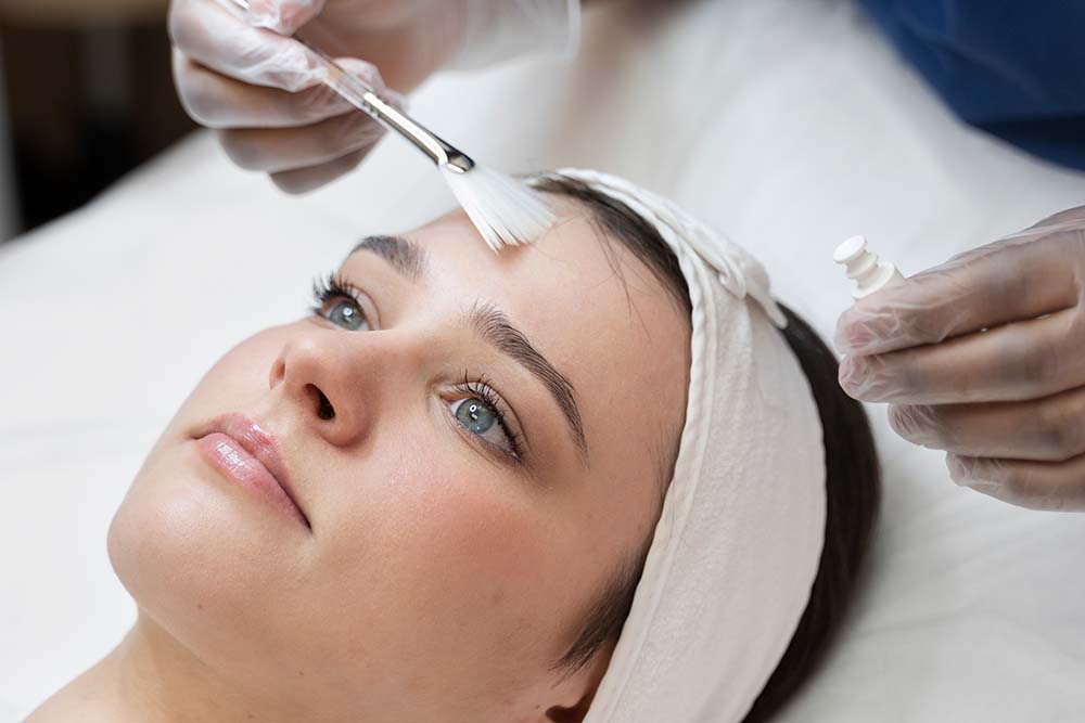Chemical Peel Treatment