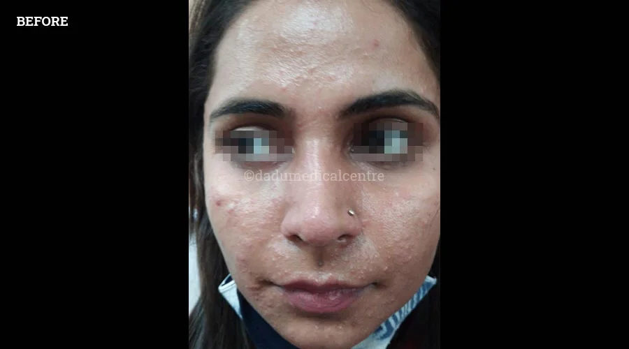 Wrong Cosmetic Products - before