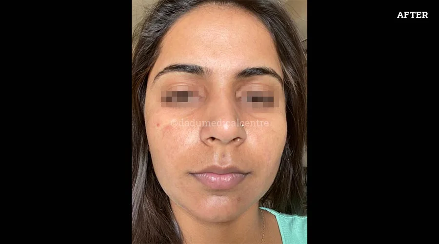 Wrong Cosmetic Products - after